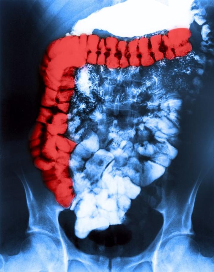 Wpływ napojów na IBS