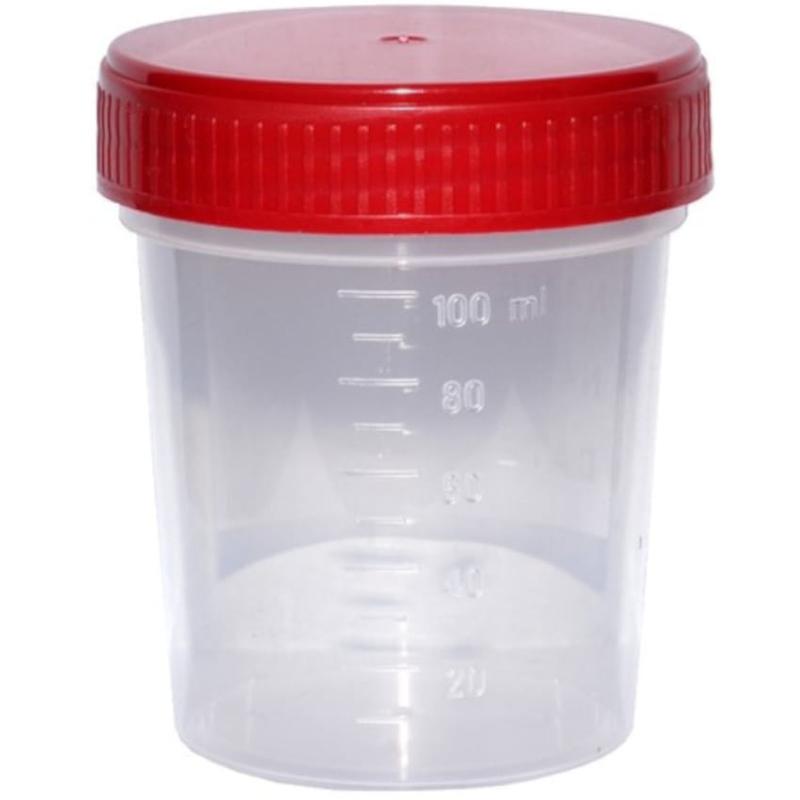 Czy zapach moczu ma znaczenie? Co wpływa na jego odmienność?