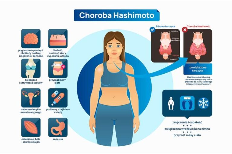 Skuteczne sposoby na redukcję zmęczenia u osób z Hashimoto