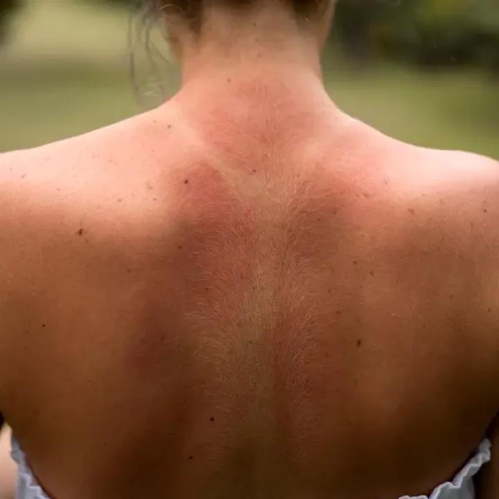 Dieta wspierająca opaleniznę