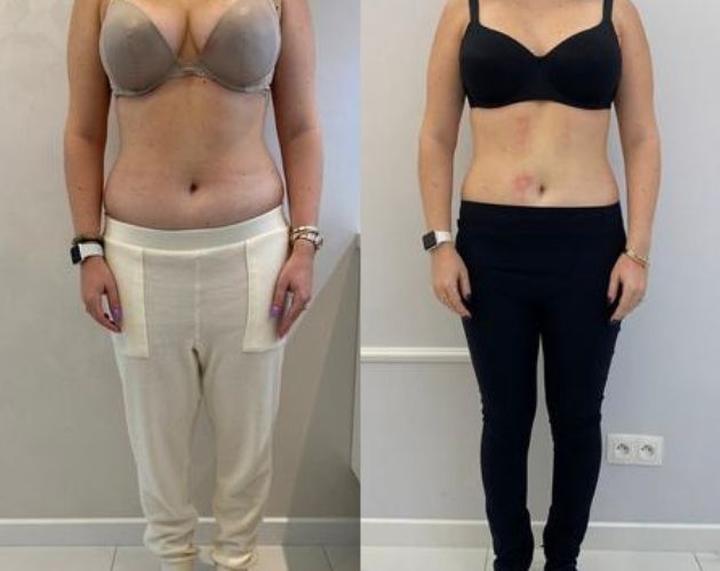 Odżywianie i suplementacja dla pełnych piersi