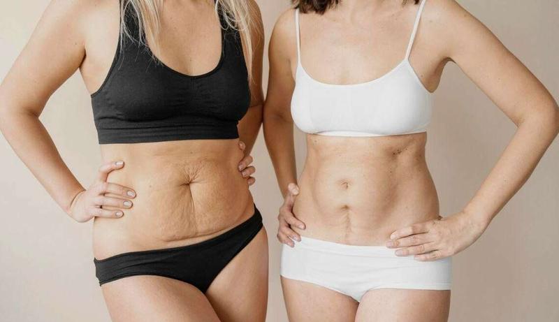 Ćwiczenia na ujędrnienie skóry