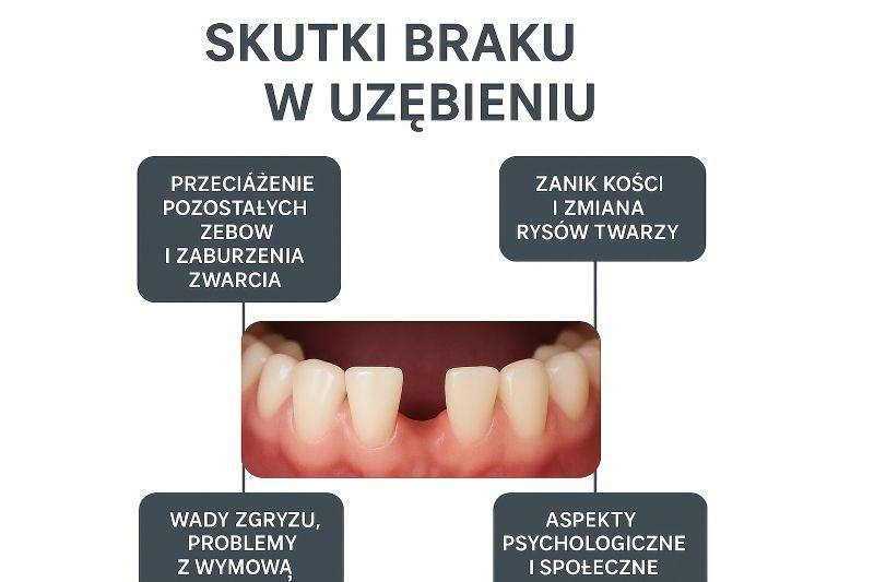 Dokładne przeżuwanie jedzenia